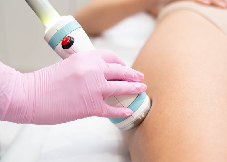 Zabiegi wyszczuplające uda – TOP 5 najlepszych zabiegów na uda